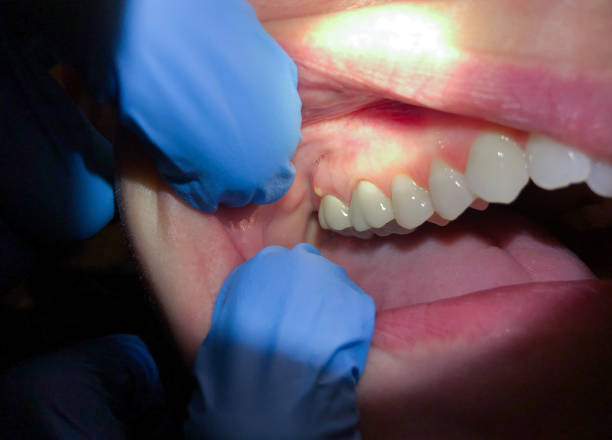 Best Emergency Dental Care for Trauma or Injury in Everett, PA